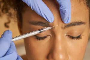 Einer Frau wird Botox zwischen die Augenbrauen injiziert