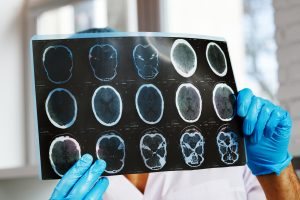 Neurologie